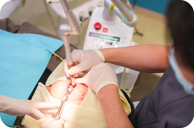 痛みや出血を抑えるレーザー治療